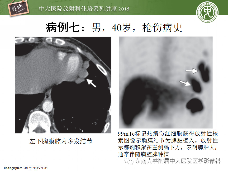 e4517fa8d0d209de52390f32005a84cb.jpg