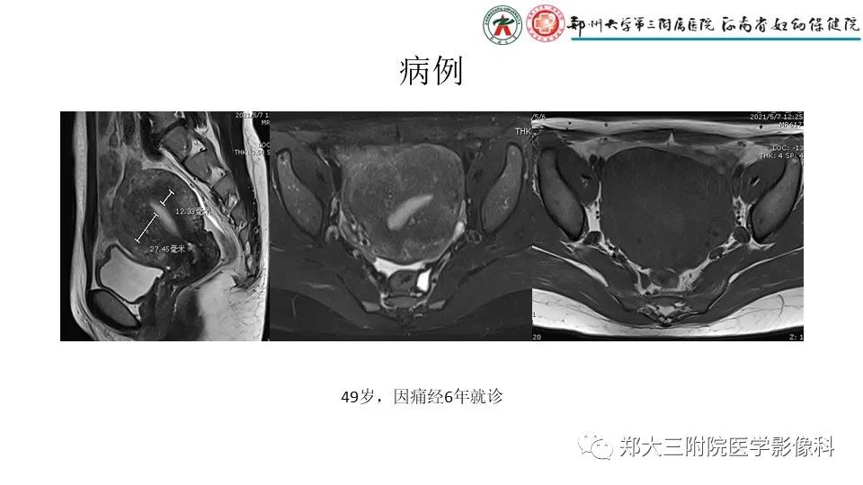 cba5245e143f2de656e7cceff6989329.jpg