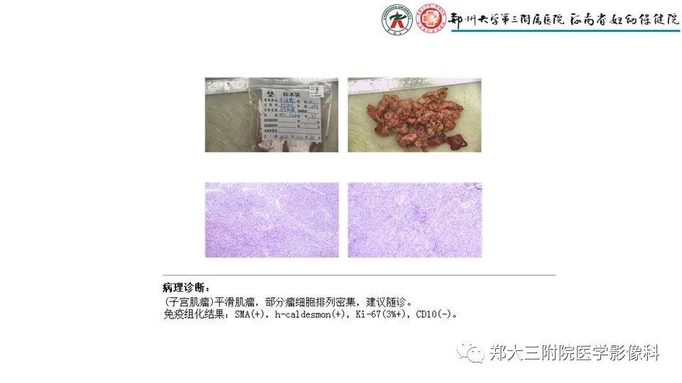 ef4e33e51b2d55c14844f6eacc85ae9f.jpg