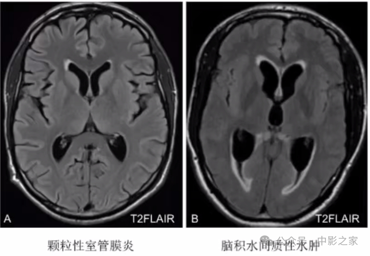 b59874768f85c3d19372cde8e3b0bc62.png