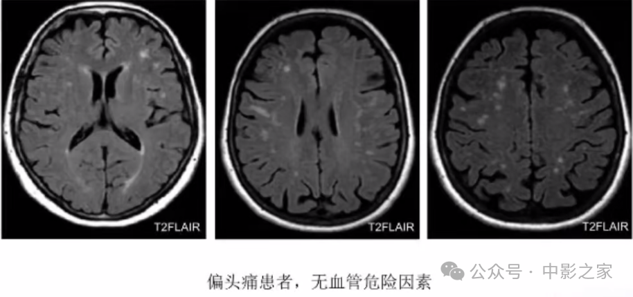 70ae3023f9ce7cff407931c18117c28d.png