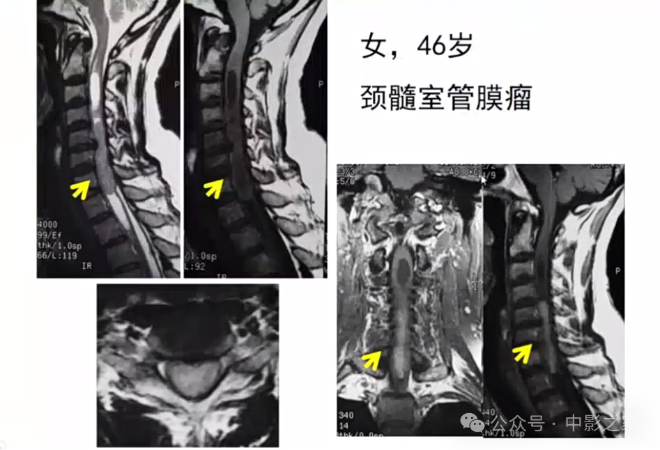 aca68b33ec522b473a3ed70b6f6eb8b4.png