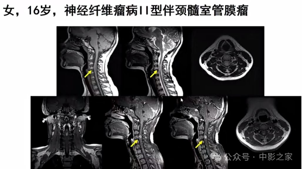 a170b719bc446c4cb6e81fa412e13935.png