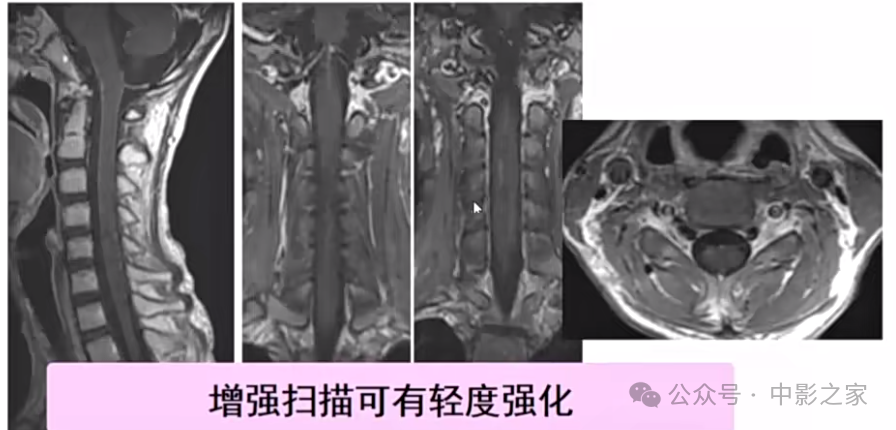 6a82417129d2c9606cf8d6fef5dc8ea3.png