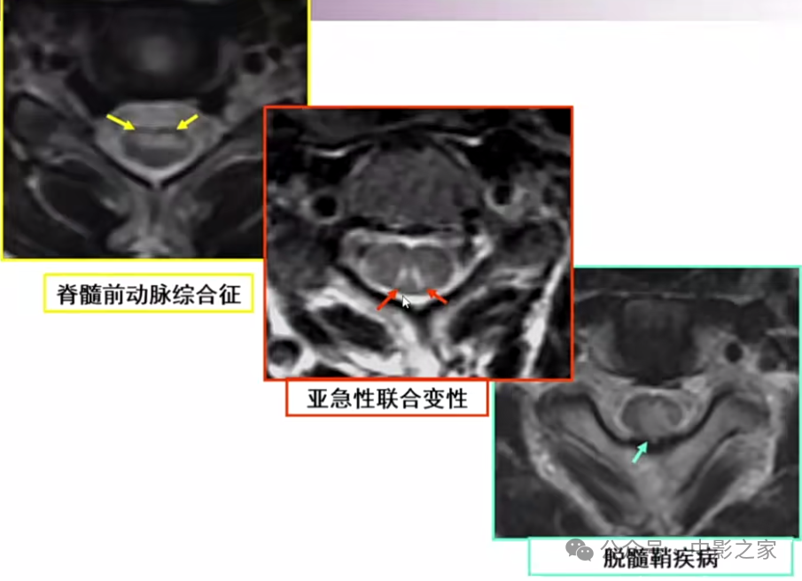 9620cf1b88861d0aef8293b2137894cc.png