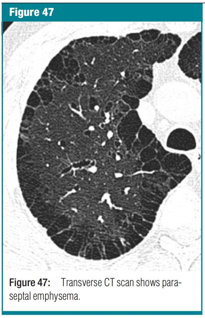 995eaed5c038d056914420543513bd00.jpg