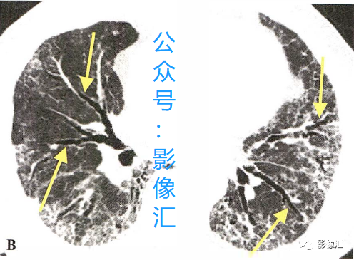 552a09837c3e3742491296ad8f36a048.png