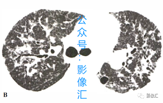 6fa1ea511d3492f155bb9dfa2fc60c55.png
