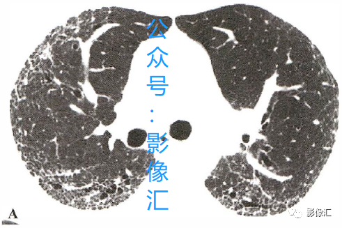 1dac86c187b2e51042a8b36088881321.png