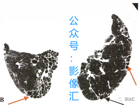 d5202dd7815c19d4ac6a7944264974c4.png