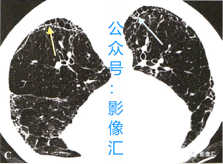 c9c7fcb59155ea404921a3164077f02d.png