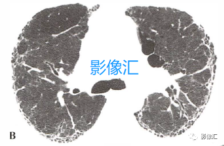 f87b19c61758d8eba94bbb54f18d406b.png