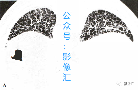 ff8f029962e1f58d417a2b9e3bbc7de4.png