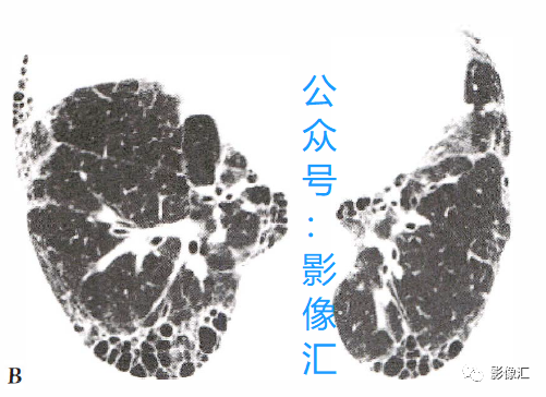 f1206fdc5c50e9251436f40be6845755.png
