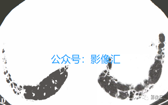 21750cae0123b9e41c3eff375a4a2f70.png
