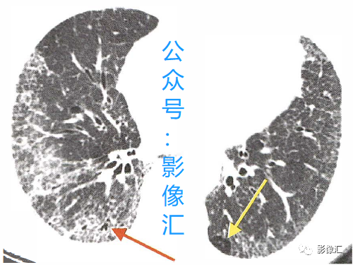 4bcbc860e3a21974e3c136bdda97a056.png