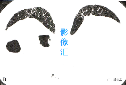 0db12436c3201c698e9e8ba03f3d9b77.png