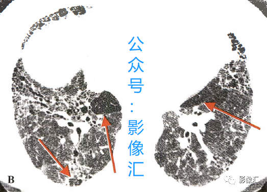 37d2c1b387d4225b39b9f158a2eff74d.png
