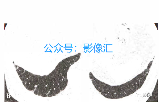 67ae4e763f239fd1fa9b42d19f580b24.png