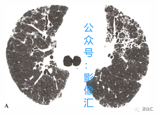 4b7c6fe8656c4c27dc86848d1dbce542.png