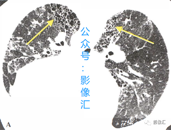f52eede57291095e06795ce208c5afca.png