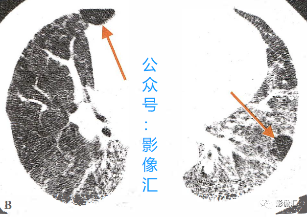 117af789243ab1b139823e06ef1ea45c.png