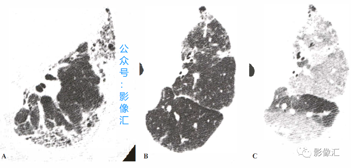 1f21babd59ce7ba8af2bb12cb2aa166b.png