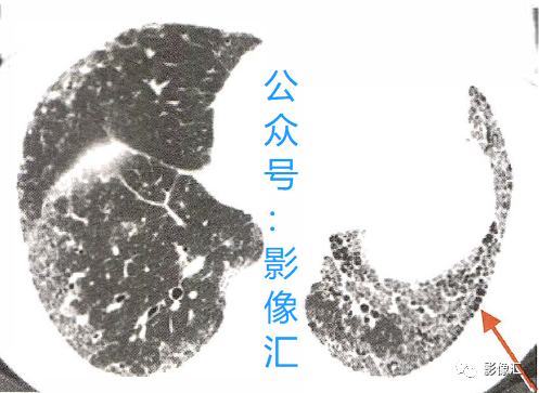 8fa6e031c3d18ee182a3c1347ee79aa9.png