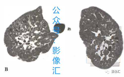 c5360271fcb92ff662f4d1a1fea1a590.png
