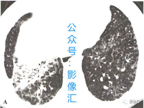 b008bcf0210294cbd7efea07f70ee244.png