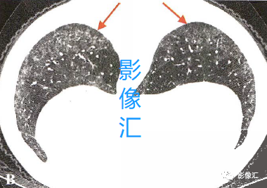 3a601c975972a8eba190cacb77fe0e83.png