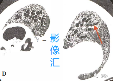ad185f6bb5b8ef421049d12637b723ec.png