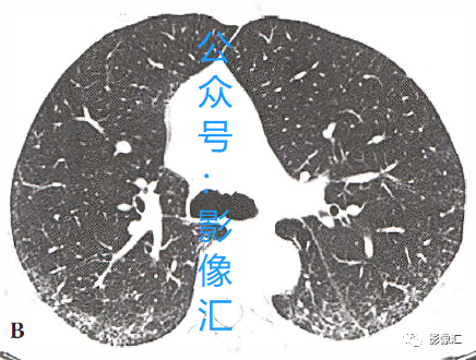 3195b08fc6be3f7f4ea647db93cb7293.png