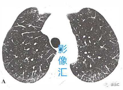 1f2134fe046a38d37eb032bca00811f1.png