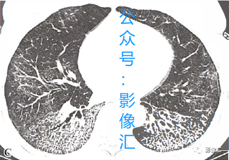 3037e9428718710b40681cad8dbcac20.png
