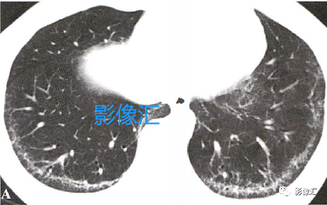 9421601ea7fd1cd5bdfca2ef0e6d3334.png