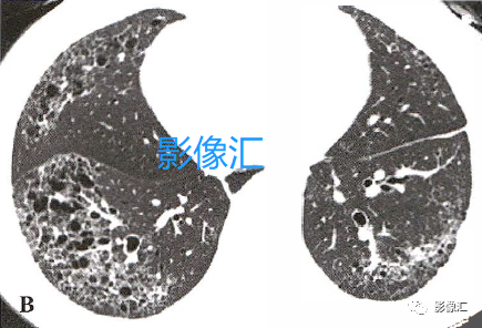 3346a2fc2bcd720399d7761ca6eba05a.png