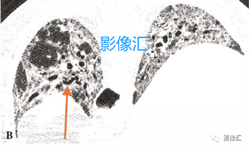 6be977be50ec7f875ec30a6cdb53945d.png