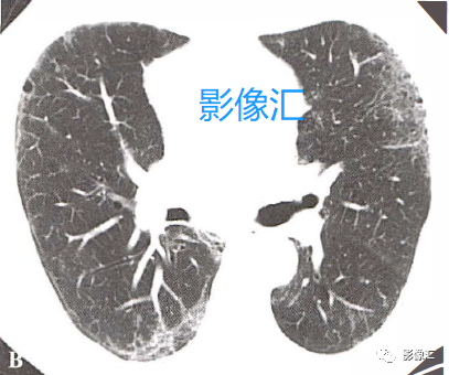 3cd2576c3eacb6c64683a92e21f6dc4a.png