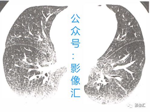 fd4a7b72342997dcf7214265189f36d7.png