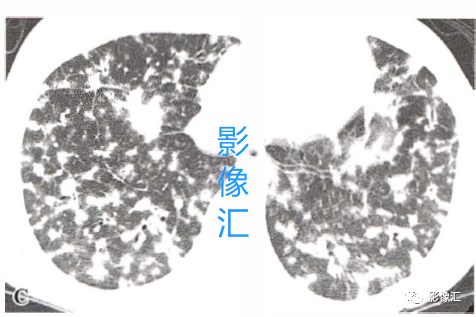 2b3aa313ef1a1f5db6c4f0657747f84e.png