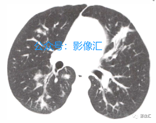 e05559e74ee76ac44b55a497796c8590.png