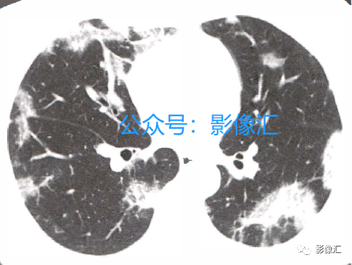 73061755bd96e3671b68e4662e2ba454.png