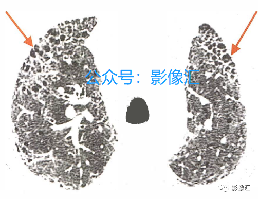 ca038794375411ac34ebf8b03d656501.png