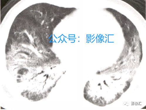 fcfa3dec27ef083d49033ee3e89e4db5.png