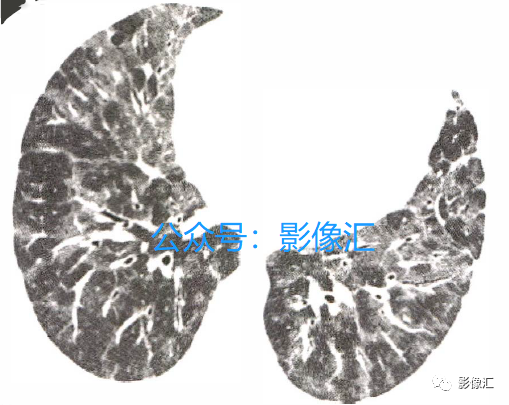 d2585176980dee4c23c0ed995e6b4d4a.png